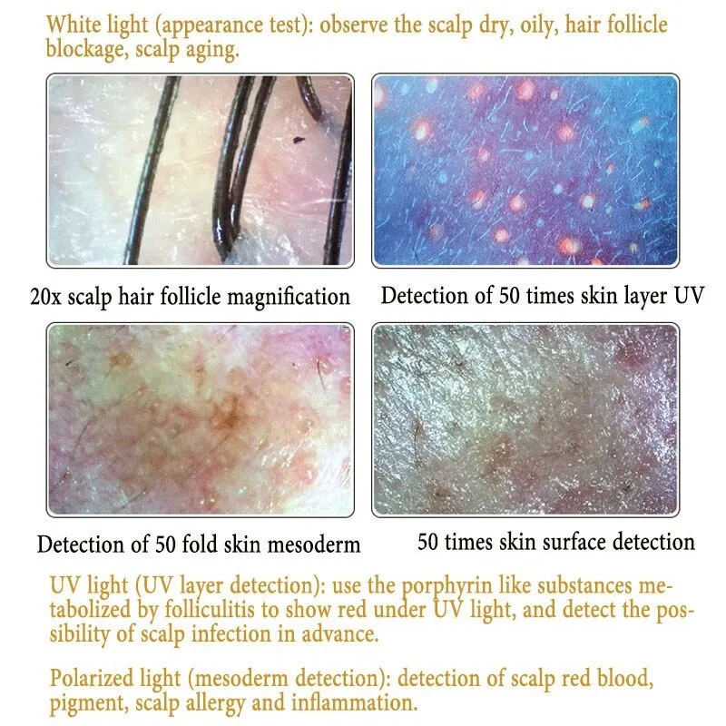 2 Probe 5X-200X Usb Intelligente Dermal Haarfollikel Detector Huid Haar Uv Analyzer Huid Testen Onderzoek Vergrootglas Analyzer